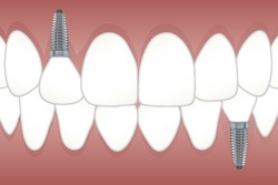 dentistlanca's Profile Photo